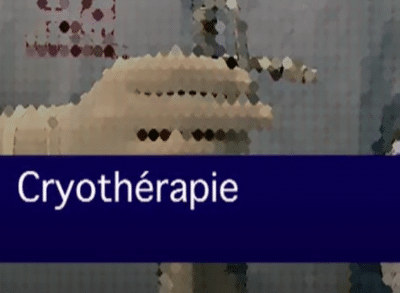 Cryothérapie