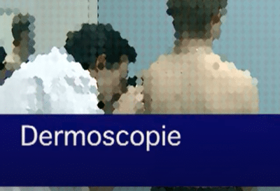 Dermatoscopie