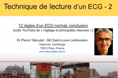 ECG -2