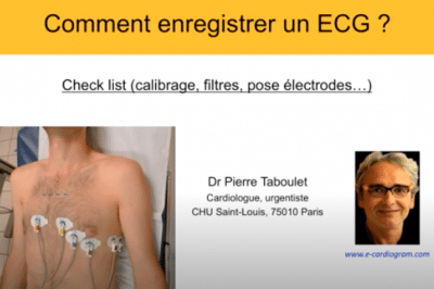 ECG -4