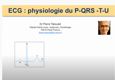 ECG -3