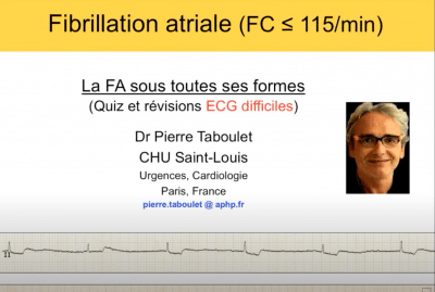 ECG -17