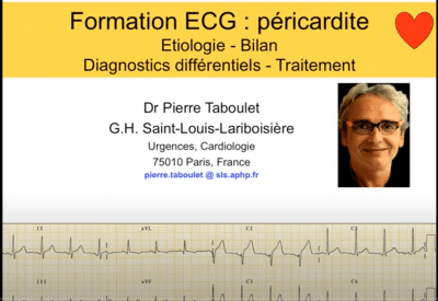 ECG -31
