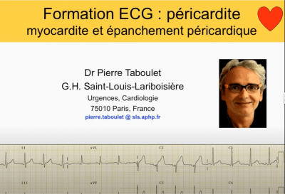 ECG -30