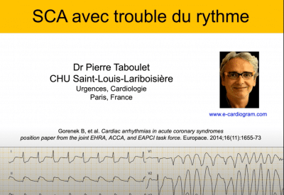 ECG -22