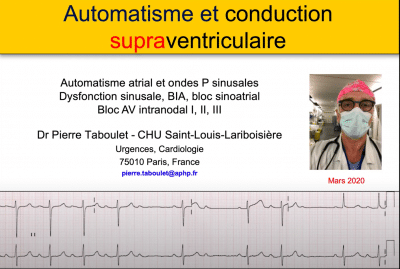 ECG -9