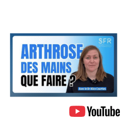 Arthrose des mains que faire ?